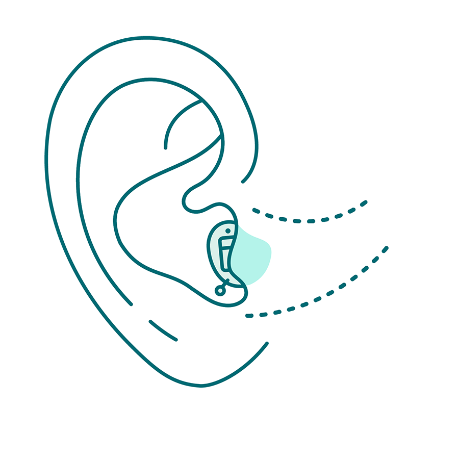 fast_unsichtbare_hoergeraete_03