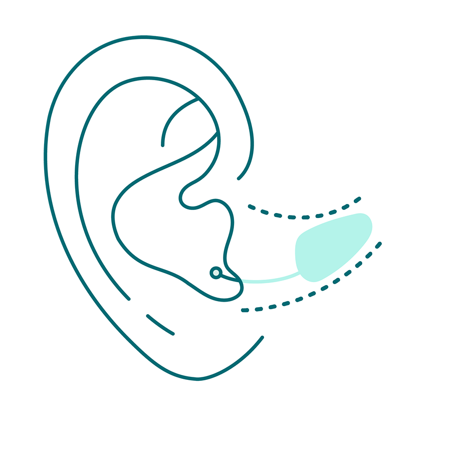 fast_unsichtbare_hoergeraete_04